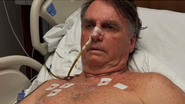 Imagem Novo boletim médico afirma que Bolsonaro segue sem previsão de alta