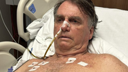 Bolsonaro internado - Foto: X/Reprodução