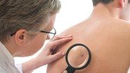 Identifique sinais de alerta e adote medidas simples para prevenir o câncer de pele e garantir sua saúde. - Reprodução/Freepik