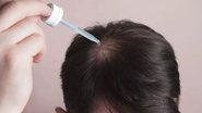 O principal item suspenso, Tônico Capilar Minoxi Turbo, fazia alegações proibidas e usava substância vetada em cosméticos. - Reprodução/Freepik