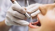 Reprodução/Thiesen odontologia