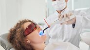 Imagem Clareamento dentário gratuito em Natal: Estudo da UFRN procura voluntários para tratamento