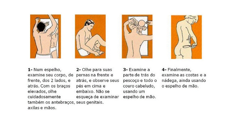 Durante todo o mês, a SBD/RN vai disponibilizar conteúdos educativos nas redes sociais, abordando sinais de alerta, cuidados essenciais com a pele e orientações de prevenção.