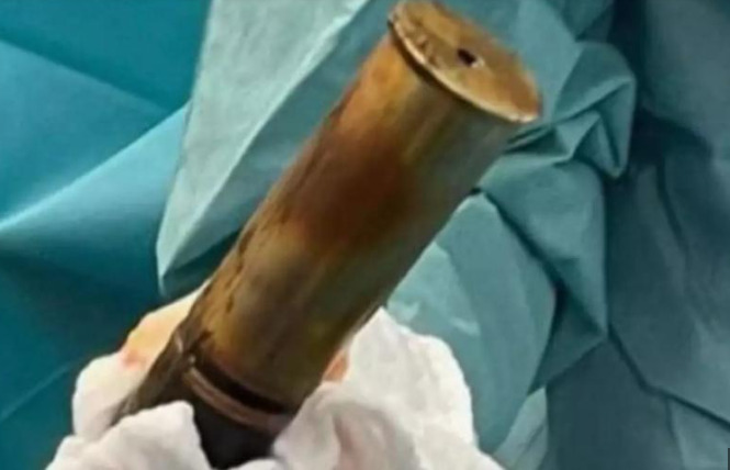 O objeto, utilizado originalmente em peças de artilharia pesada, é diferente das granadas de mão por ser projetado para disparos de longa distância a partir de canhões específicos.