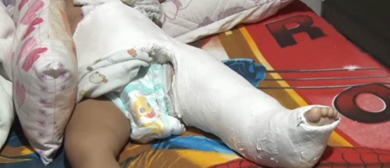 Bebê foi atingido enquanto estava no carrinho em avenida da Zona Norte. Foto: Reprodução/TV Ponta Negra
