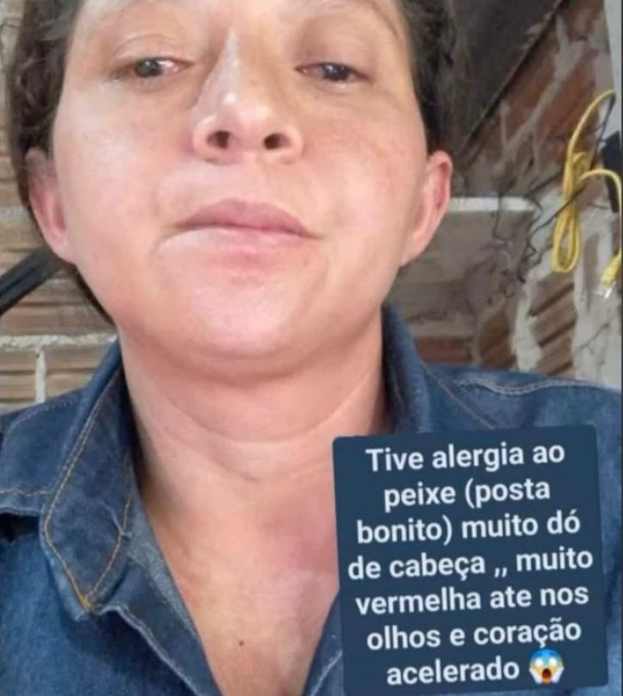 Entre os depoimentos, uma moradora afirmou ter apresentado sintomas como dor de cabeça intensa, vermelhidão nos olhos e na pele, e aceleração dos batimentos cardíacos.