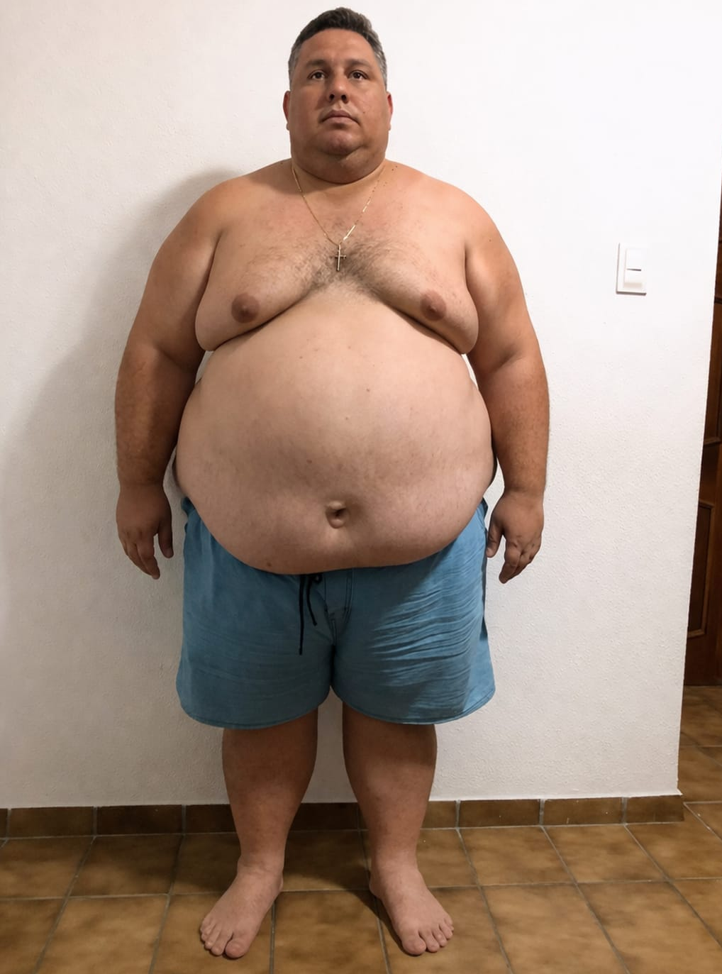 Zé da Farmácia, quando chegou a pesar mais de 200 quilos