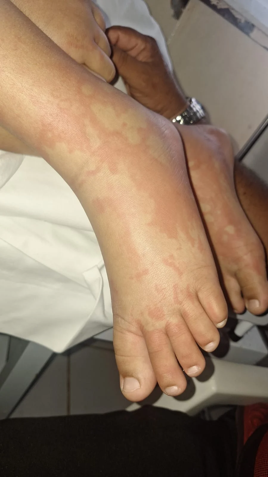 O infectologista Dr. Kleber Luz esclareceu o caso e descartou a contaminação pelo produto.