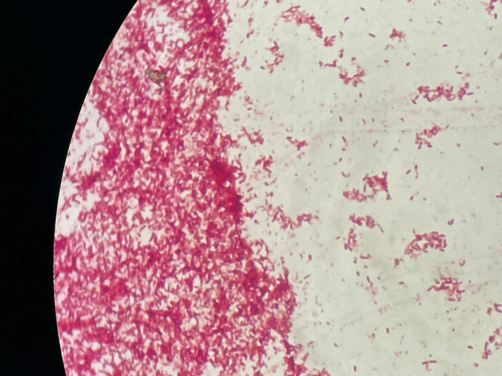 Bactéria Pseudomonas aeruginosa está presente em diversos ambientes, principalmente hospitalar e lugares úmidos e aquáticos - UFRN